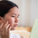 رازهای پنهان مراقبت از پوست: ۵ عادت ساده برای پیشگیری و درمان جوش