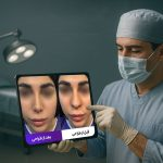 جراحی بینی در تهران با پزشک ۲۴